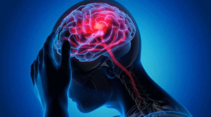 Gráfico de síntomas de tumores cerebrales